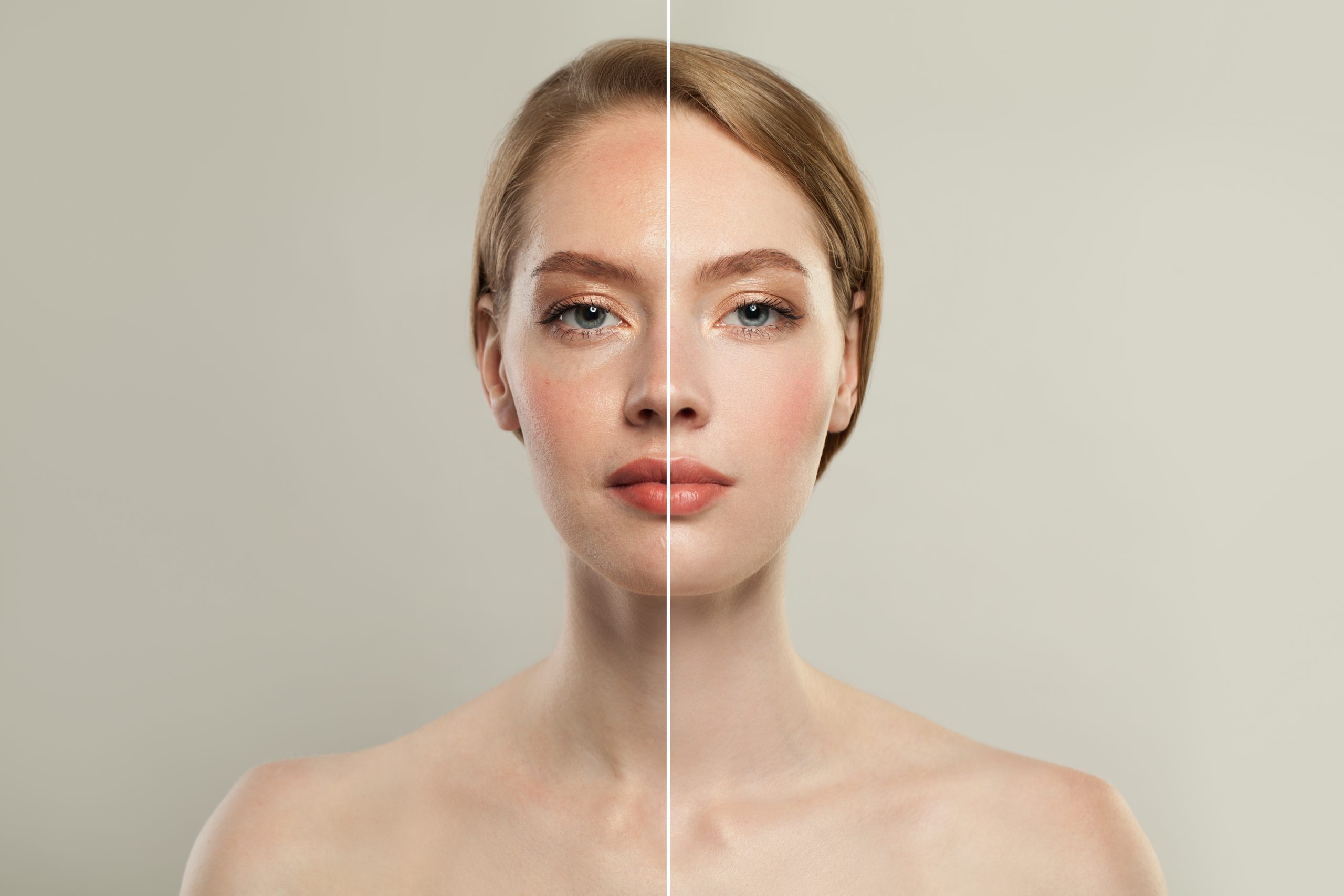 Секреты здорового цвета лица и как улучшить тон кожи